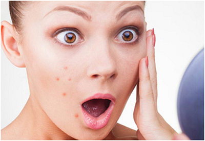 Get Rid of the Acne with Our Treatment