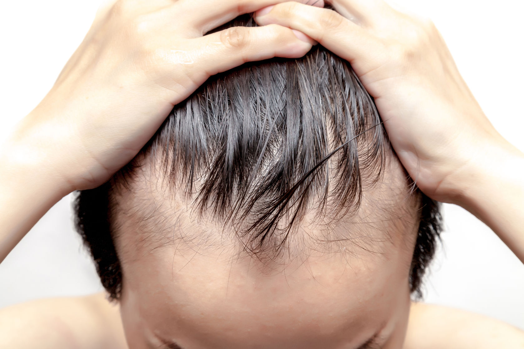 Hair Fall Treatment in Lucknow
